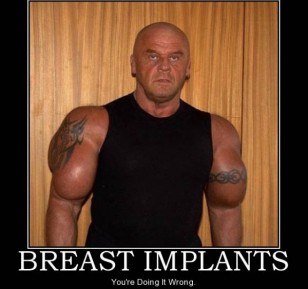 Breast Implants Gone Wrong
